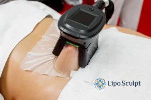 Cryolipolysis Helping You Getting that Perfect Summer Body 3 Cryolipolysis Guildford can give you the best summer body - contact us today!