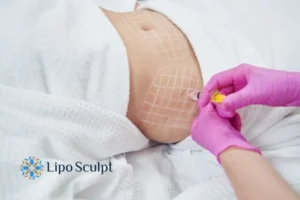 Are The Results From Aqualyx Permanent? 1 Do you want to know how long Aqualyx Guildford results last?