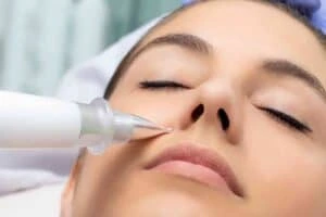 Best Actinic Keratoses Removal 3 Actinic keratoses Guildford solutions - book in today!